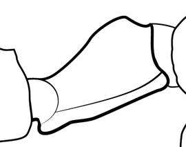 Lateral view of petiole, adult worker. The petiolar node has a convex dorsal face and the dorsal profile slopes anteriorly. In Antkey used to separate  Crematogaster obscurata  from  Crematogaster scutellaris .