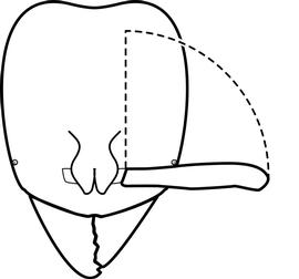 Anterior view of antennal scape, adult worker. The antennal scapes, when arranged along the anteroposterior axis of the head, do not reach the posterior head margin. Used in Antkey to separate  Hypoponera punctatissima, Hypoponera ragusai  and  Hypoponera zwaluwenburgi  from  Hypoponera opaciceps  and  Pachycondyla  species.