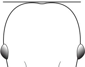 Anterior view of head, adult worker. The posterior margin of the head generally flat and broad before arching towards eyes. Used in Antkey to separate  Pheidole bilimeki  from  Pheidole anastasii  and  Pheidole .