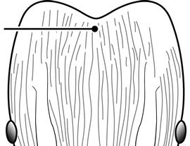 Anterior view of head, adult worker. Carinae approaching posterior head margin. This character state was used by Wilson (2003) to distinguish  Pheidole flavens  from  Pheidole moerens . However, the character is ambiguous and variable, and may have been based upon examination of a limited amount of material.