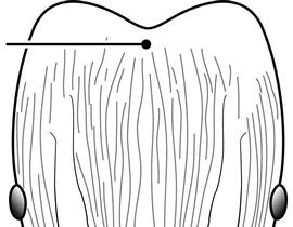 Anterior view of head, adult worker. This character state was used by Wilson (2003) to distinguish  Pheidole moerens  from  Pheidole flavens . However, the character is ambiguous and variable, and may have been based upon examination of a limited amount of material.