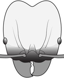 Anterior view of head, adult worker. The head is bicolored with the yellowish posterior two-thirds contrasting with the darker brown anterior third and rest of body. Used in Antkey to separate  Pheidole punctatissima  from  Pheidole anastasii  and  Pheidole bilimeki .