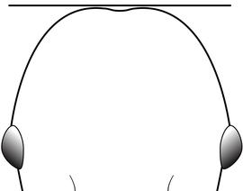 Anterior view of head, adult worker. The posterior margin of the head generally convex and narrow before arching towards the eyes. Used in Antkey to separate  Pheidole punctatissima  from  Pheidole bilimeki  and  Pheidole anastasii .