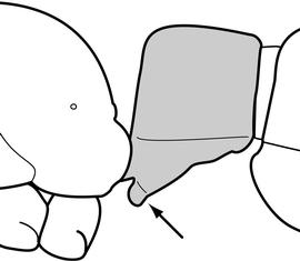 Lateral view of petiole, adult worker. The subpetiolar processandnbsp;broad and with fenestra present.