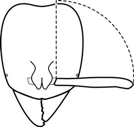 Anterior view of antennal scape, adult worker. The antennal scapes, when arranged along the anteroposterior axis of the head, extend beyond the posterior head margin. Used in Antkey to separate  Hypoponera opaciceps  and  Pachycondyla  species from  Hypoponera punctatissima, Hypoponera ragusai  and  Hypoponera zwaluwenburgi .