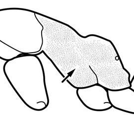 Lateral view of body, surface characters, adult worker. The mesopleura and metapleural bulla covered with dense pubescence giving the surface a dull appearance. Used in Antkey to separate  Linepithema humile  from  Linepithema iniquum .