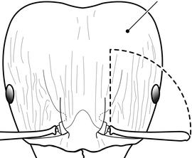 Anterior view of head, adult worker. The posterior third of cephalic dorsum smooth and shining with at most a few short interrupted carinae. Used in Antkey to separate major workers of  Pheidole megacephala  from those of other  Pheidole  species.