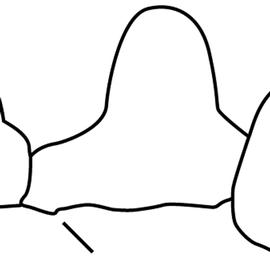 Lateral view of petiole, adult worker. The subpetiolar process is weak to absent, never as a well developed flange or lobe. If a process is present, it is located at the far anterior end of the petiole and maybe be difficult to see on most specimens. Used in Antkey to separate  Solenopsis geminata  from  Solenopsis xyloni .
