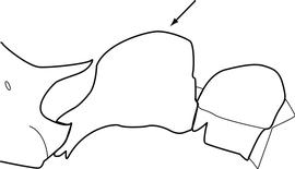 Lateral view of petiole, adult worker. Petiolar node has an anterior and dorsal face that are nearly fused into a single curve that reaches it highest point just before sharply cornering into the nearly flat posterior face. Separates  Tetramorium insolens  and  T. pacificum  from congeners.