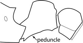 Lateral view of petiole, adult worker. Petiolar peduncle is relatively thick in profile. Separates  Tetramorium simillimum  from  T. caldarium . However, the usefulness of this character needs to be confirmed.