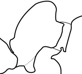 Lateral view of petiole, adult worker. Petiolar node tall and narrow and the subpetiolar process narrow with a blunt posterior angle and lacking a distinct anterior angle. Separates  Gnamptogenys porcata  from  G. triangularis .