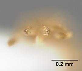 Anterior view of mandibles, adult.