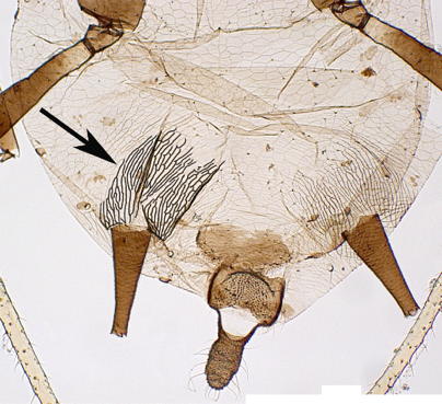 Abdominal striations