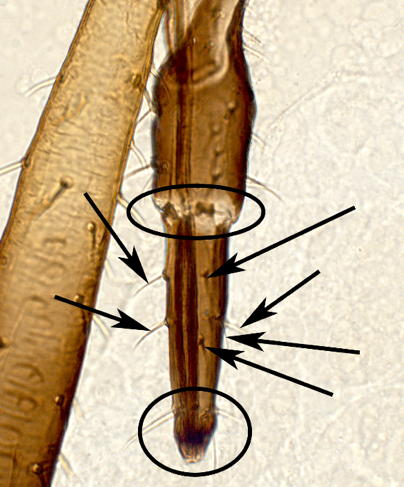 Rostral accessory setae