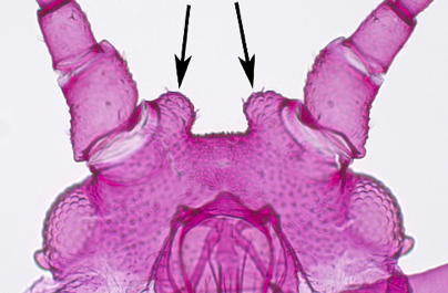 Antennal tubercles converging