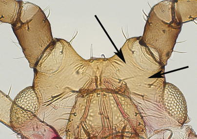 Head spicules absent