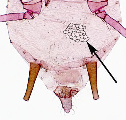 Abdominal reticulations