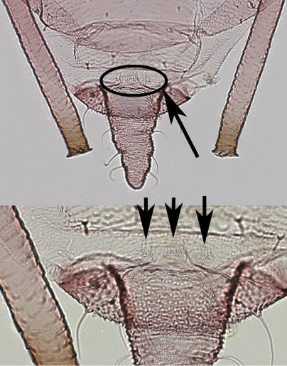 Rudimentary gonophyses details