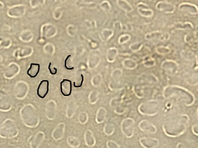 Abdominal sculpturing