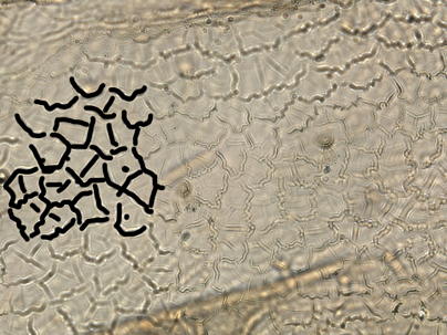 Abdominal sculpturing