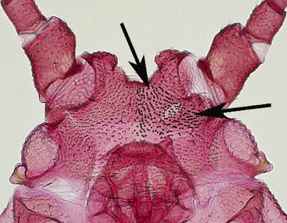 Prominent head spicules