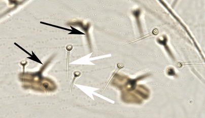 Ventral abdominal setae