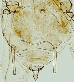Abdomen of alata