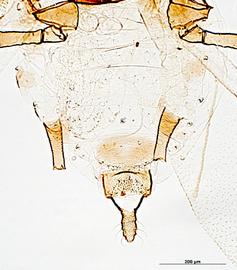 Abdomen of alata