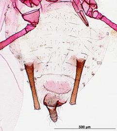Abdomen of alata