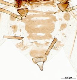 Abdomen of alata