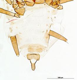 Abdomen of alata