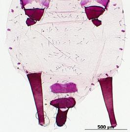 Abdomen of aptera