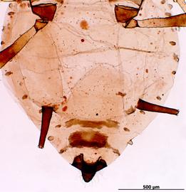 Abdomen of aptera