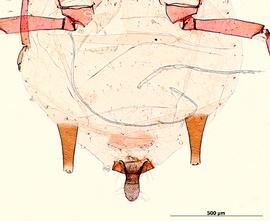 Abdomen of aptera
