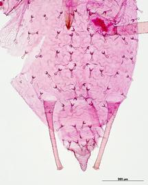 Abdomen of aptera