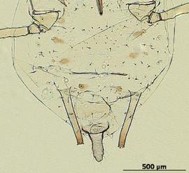 Abdomen of aptera