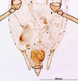 Abdomen of aptera