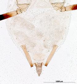 Abdomen of aptera