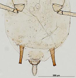 Abdomen of aptera