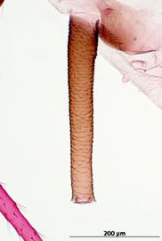 Siphunculus of alata