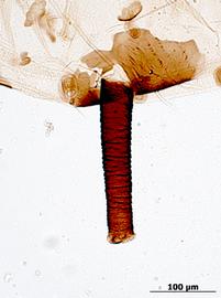 Siphunculus of alata