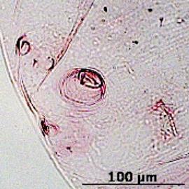 Siphunculus of alata