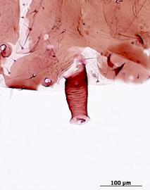 Siphunculus of alata