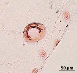 Siphunculus of alata