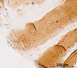 Siphunculus of alata