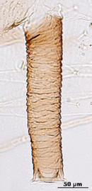 Siphunculus of alata