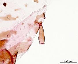 Siphunculus of alata