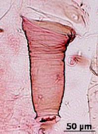 Siphunculus of alata