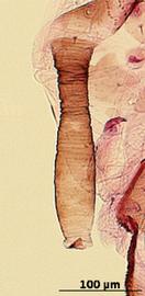 Siphunculus of alata