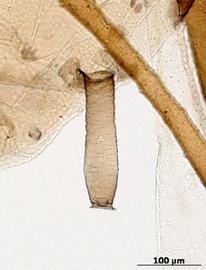 Siphunculus of alata